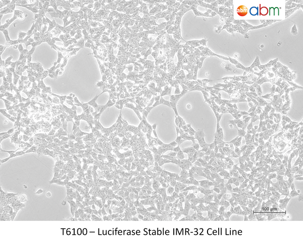 Luciferase Stable IMR-32 Cell Line – Figure 1 of 1