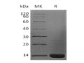 Recombinant Human Beta-2-Microglobulin/B2M Protein (E.coli, His Tag) – Figure 1 of 2