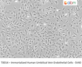 Immortalized Human Umbilical Vein Endothelial Cells - SV40 | Applied Biological Materials (abm)