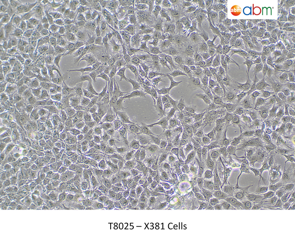 X381 Cells – Figure 1 of 1