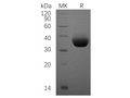 Recombinant Human PD-L1/B7-H1/CD274 Protein (His Tag) – Figure 1 of 2