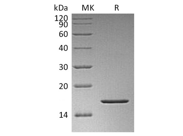 Recombinant Human FGF-2/FGF basic/FGFb Protein – Figure 1 of 3