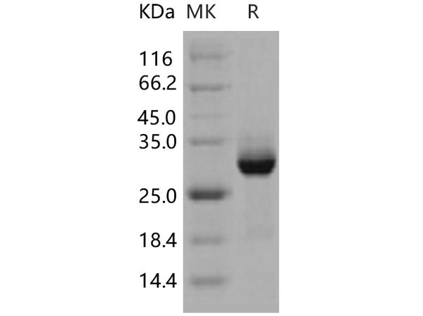 Recombinant Human AKT3 Protein (GST Tag) – Figure 1 of 2