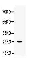 Anti-TNF alpha Antibody Picoband®