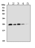 Anti-TNF alpha Antibody Picoband®