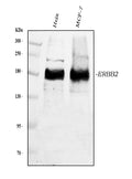 Anti-ErbB 2/ERBB2 Antibody Picoband®