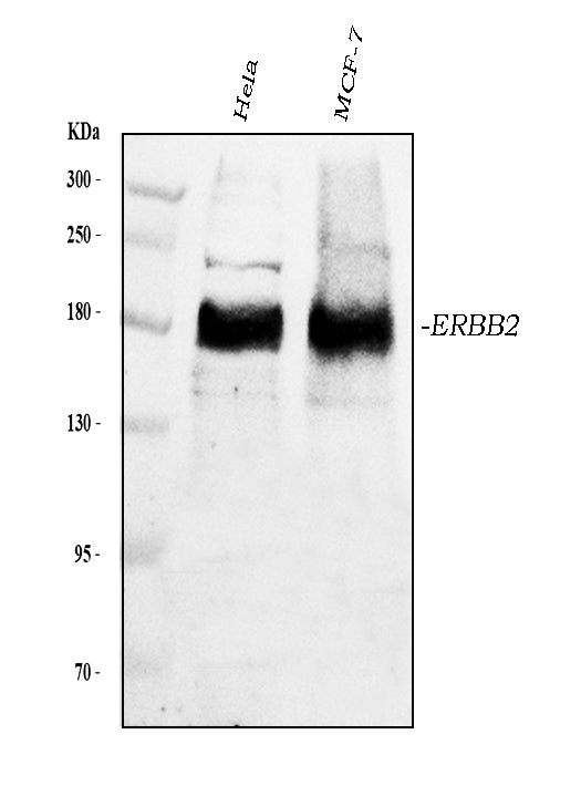 Anti-ErbB 2/ERBB2 Antibody Picoband®