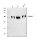 Anti-HER2/ERBB2 Antibody Picoband®