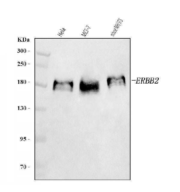Anti-HER2/ERBB2 Antibody Picoband®