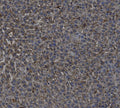 Anti-TGF beta 1/TGFB1 Antibody
