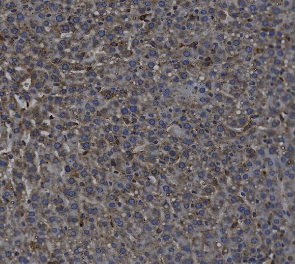 Anti-TGF beta 1/TGFB1 Antibody