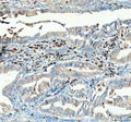 Anti-CTLA4 Antibody