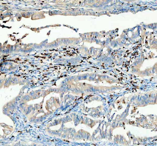 Anti-CTLA4 Antibody