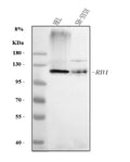 Anti-RB1 Antibody Picoband®