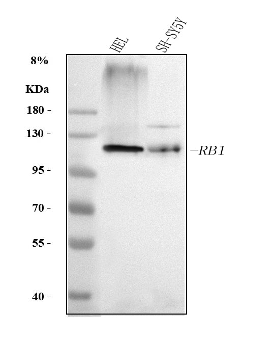 Anti-RB1 Antibody Picoband®