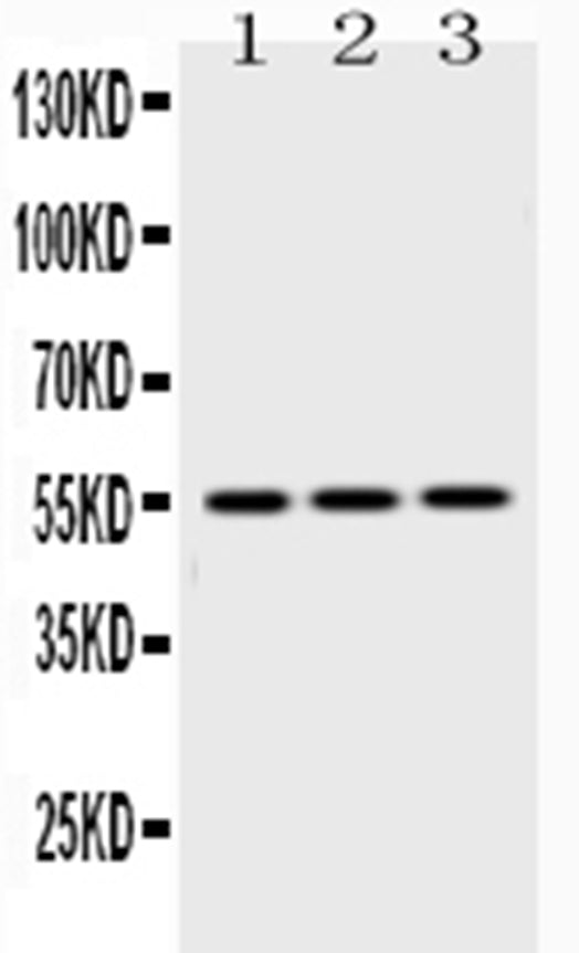 Anti-Caspase 8/CASP8 Antibody Picoband®