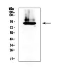 Anti-Prothrombin/F2 Antibody Picoband®
