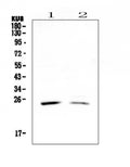 Anti-StAR Antibody Picoband®