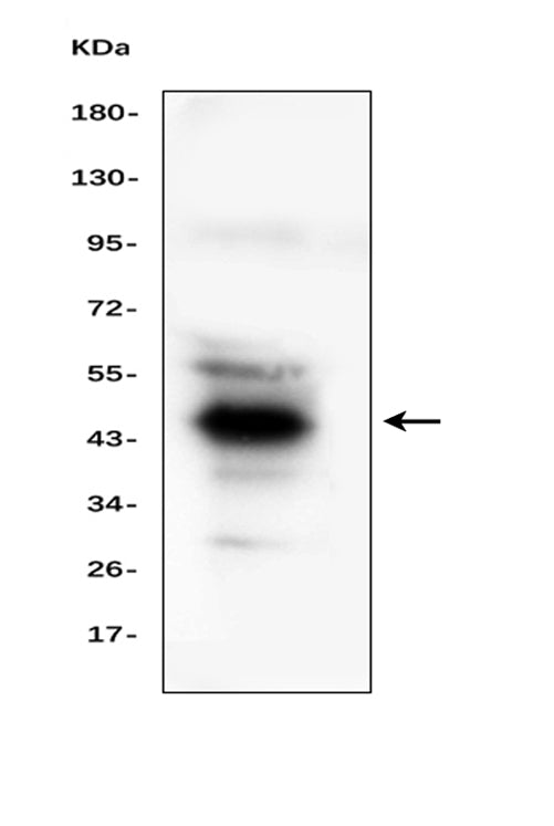 Anti-Haptoglobin/HP Antibody Picoband®