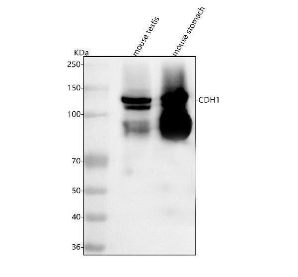 Anti-E-cadherin/Cdh1 Antibody Picoband®