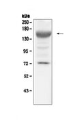 Anti-IGF1 Receptor/Igf1r Antibody Picoband®