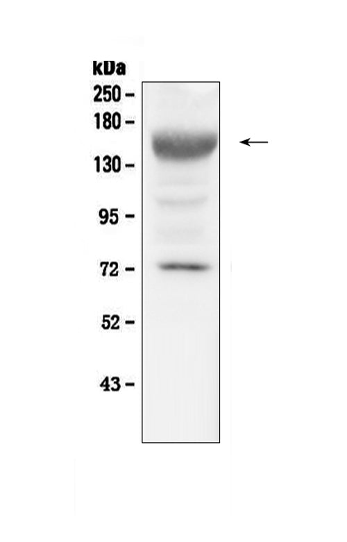 Anti-IGF1 Receptor/Igf1r Antibody Picoband®