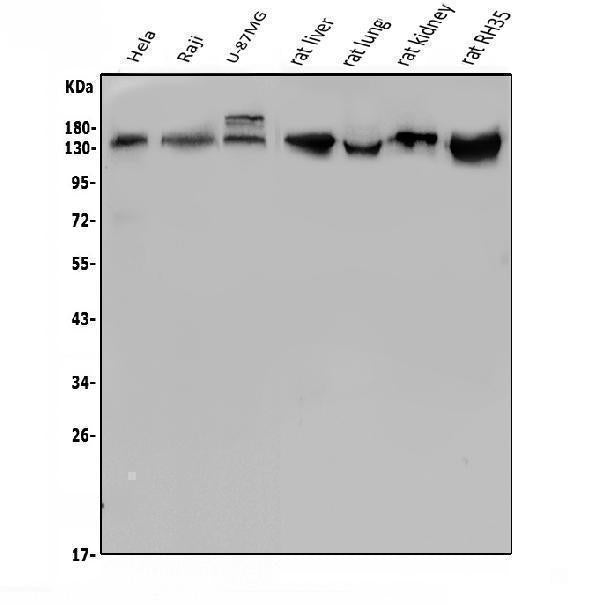 Anti-LDL Receptor/LDLR Antibody Picoband®