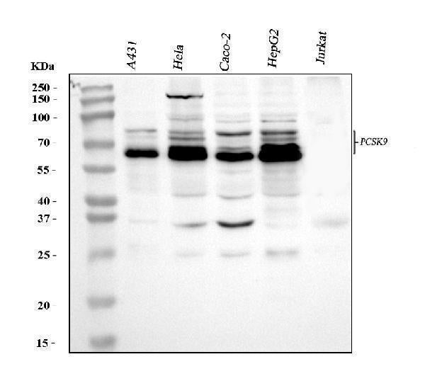Anti-PCSK9 Antibody Picoband®