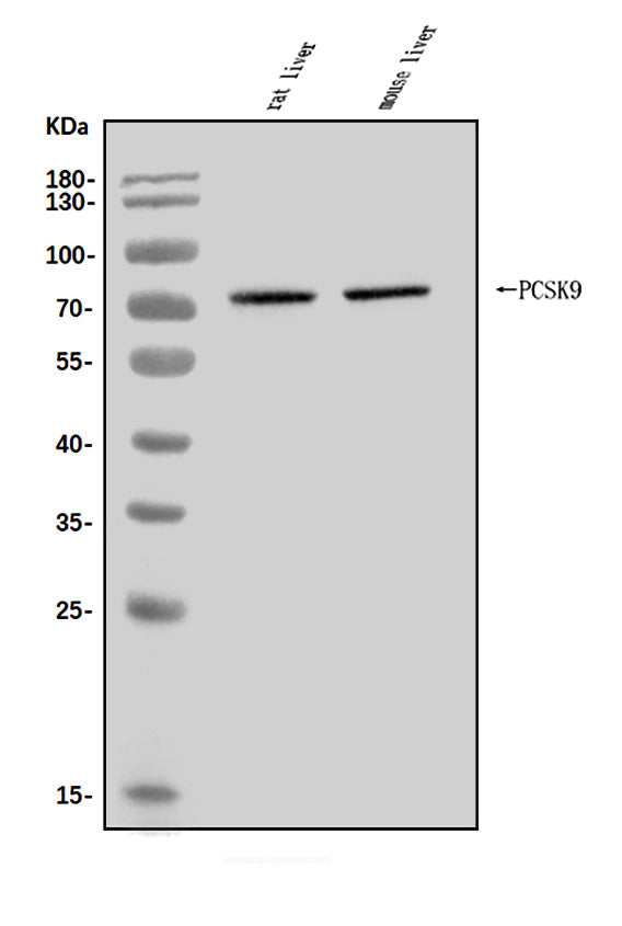 Anti-PCSK9 Antibody Picoband®