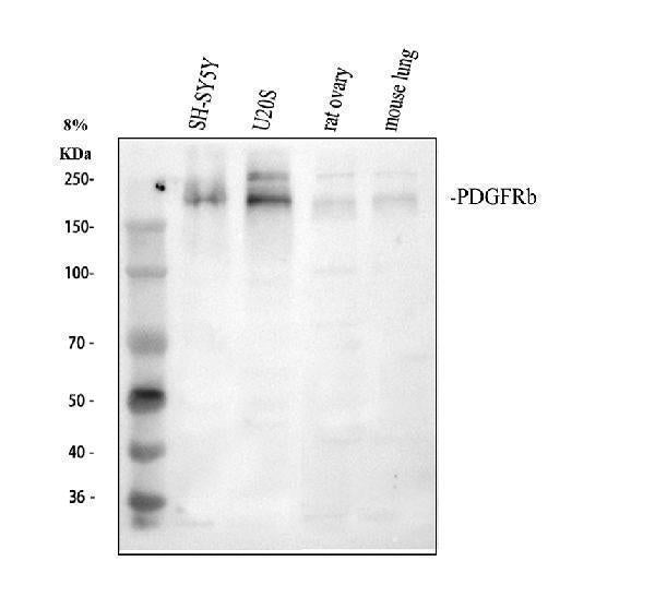 Anti-PDGF Receptor beta/PDGFRB Antibody Picoband®
