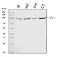 Anti-TRPV1 Antibody Picoband®