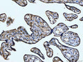 Anti-CD14 Antibody