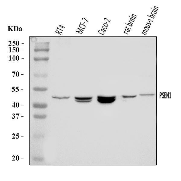 Anti-Presenilin 1/PS-1/PSEN1 Antibody Picoband®