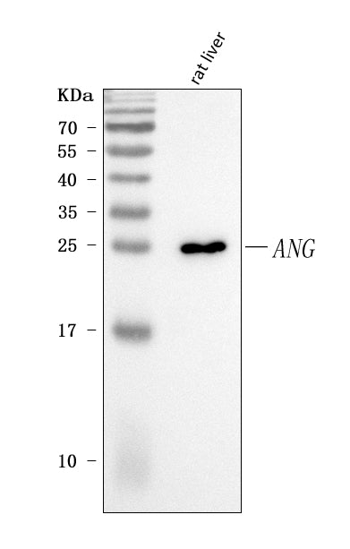 Anti-Angiogenin/Ang Antibody Picoband®
