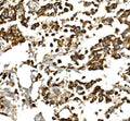 Anti-IGF1 Antibody