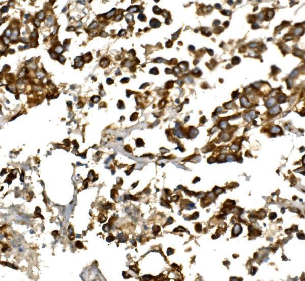 Anti-IGF1 Antibody
