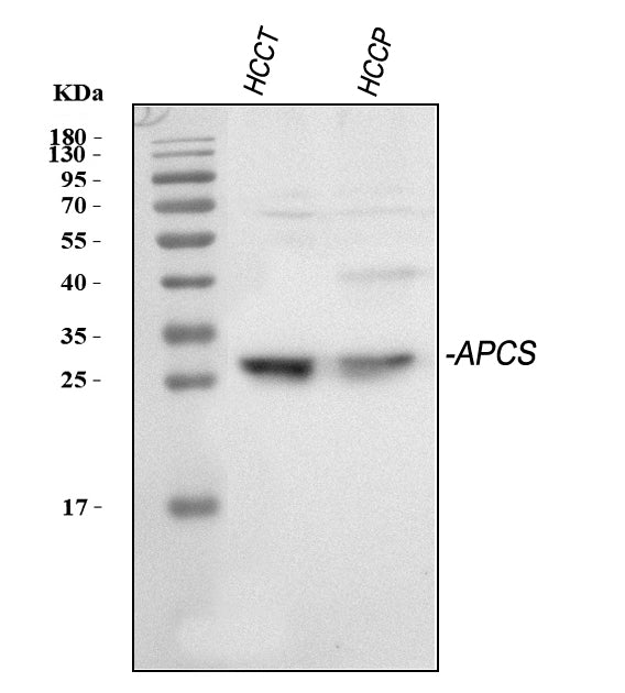 Anti-Serum Amyloid P/APCS Antibody Picoband®