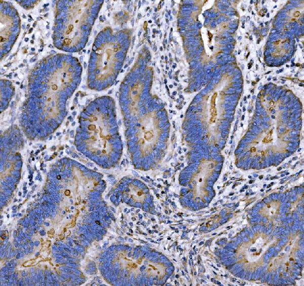 Anti-MUC1 Antibody