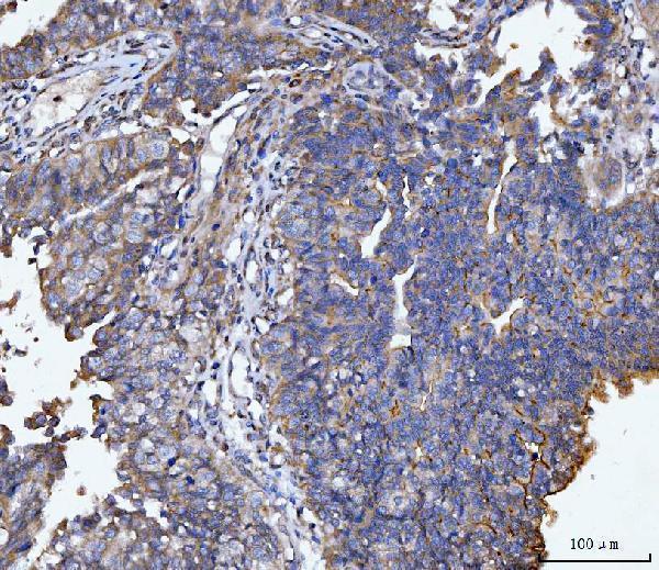 Anti-MUC1 Antibody
