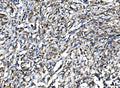Anti-IL15 Antibody
