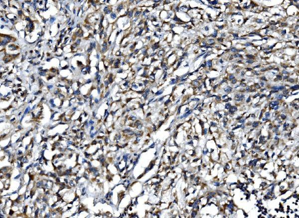 Anti-IL15 Antibody