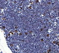 Anti-Il2ra Antibody