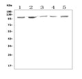 Anti-Aryl hydrocarbon Receptor/Ahr Antibody Picoband®