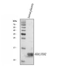 Anti-Hemoglobin/HBA1/HBA2 Antibody Picoband®