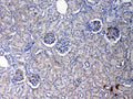 Anti-C Reactive Protein/Crp Antibody Picoband®