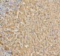 Anti-C Reactive Protein/CRP Antibody Picoband®