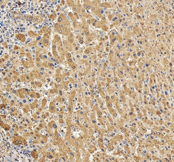 Anti-C Reactive Protein/CRP Antibody Picoband®