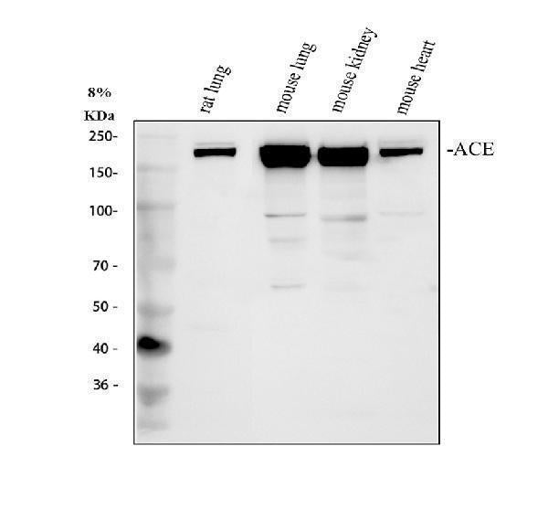 Anti-Angiotensin Converting Enzyme 1/Ace Antibody Picoband®