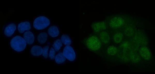 Anti-ATR Antibody