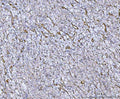 Anti-Von Willebrand Factor/VWF Antibody